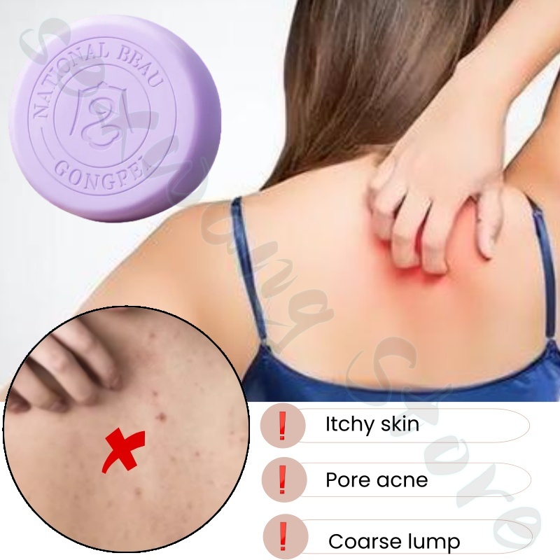 El jabón con ácido salicílico  - Salicylic Acid Blackhead Remover reseña y precio